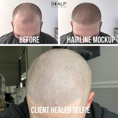 Hairline tattoo for men digital mockup compared to 1 month healed client selfie