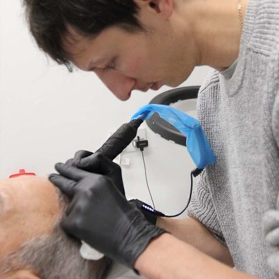 laurentiu bradea is a leading Scalp Micropigmentation artist in Birmingham UK with 500 satisfied customers over his career