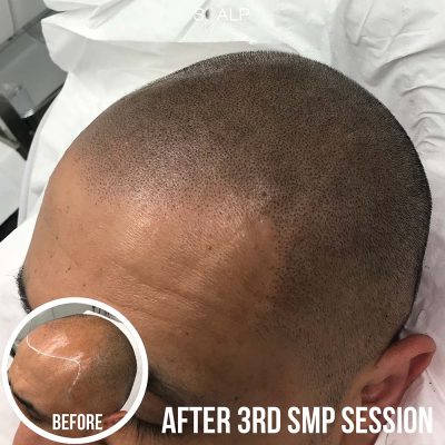 shaved hair tattoo for asian male, brown skin halal hair treatmen birmingham ukt